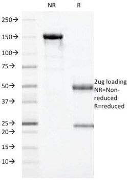HLA DRA Antibody (19-26.1 (same as MB-26.1)), Novus Biologicals 0.2mg;